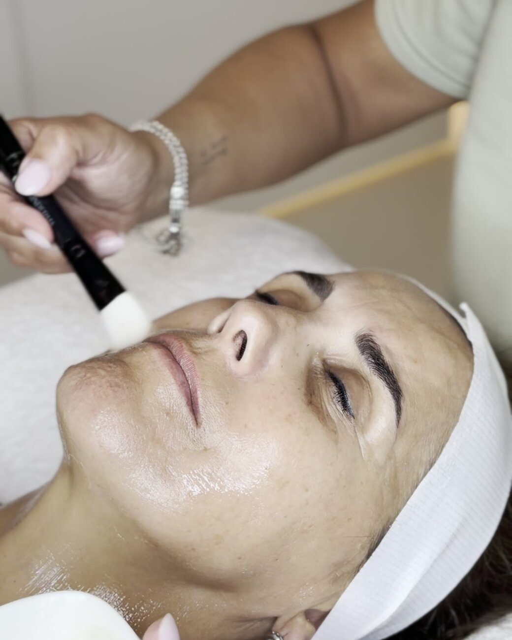 Aplicación del peeling enzimático